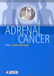 Adrenal cancer