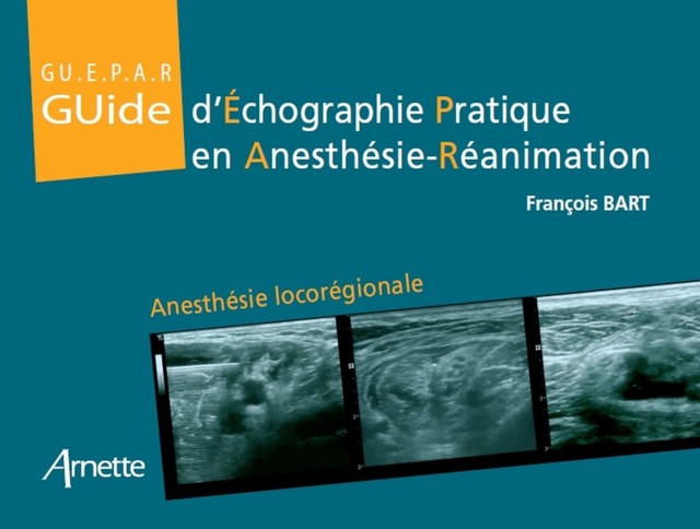 Guide d'échographie pratique en anesthésie-réanimation - François Bart, Elisabeth Gaertner - John Libbey Eurotext