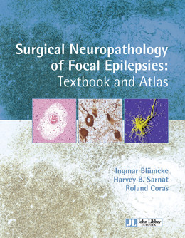 Surgical neuropathology of focal epilepsies - Ingmar Blümcke, Harvey B. Sarnat, Roland Coras - John Libbey