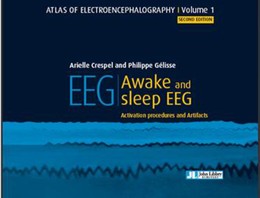 EEG - Awake and sleep EEG - Arielle Crespel, Philippe Gélisse - John Libbey