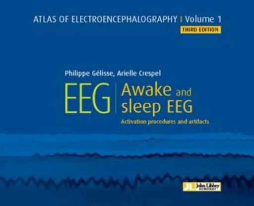 EEG : Awake and Sleep - Philippe Gélisse, Arielle Crespel - JLE