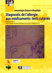 Diagnostic de l'allergie aux médicaments : tests cutanés