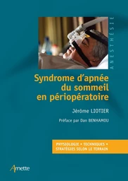 Syndrome d'apnée du sommeil en périopératoire - Jérôme Liotier - JLE