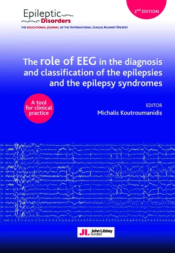 The role of EEG in the diagnosis and classification of the epilepsies and the epilepsy syndromes - Michalis Koutroumanidis - JLE